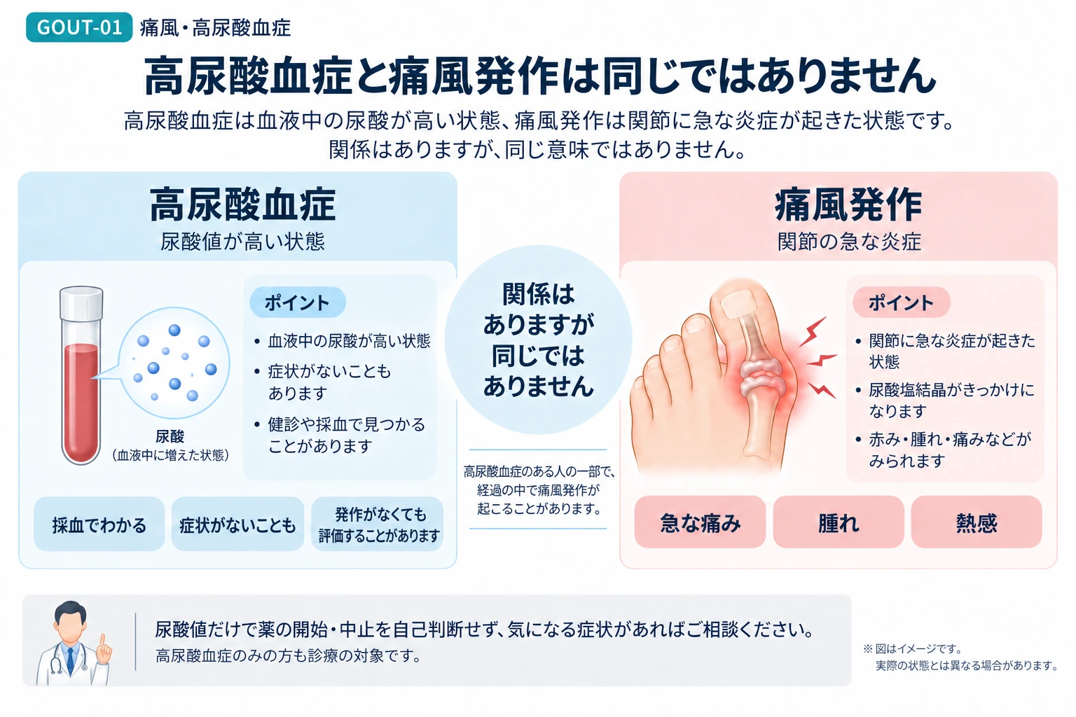 高尿酸血症と痛風発作は同じではなく、血液中の尿酸が高い状態と関節の急な炎症を比較して説明する図