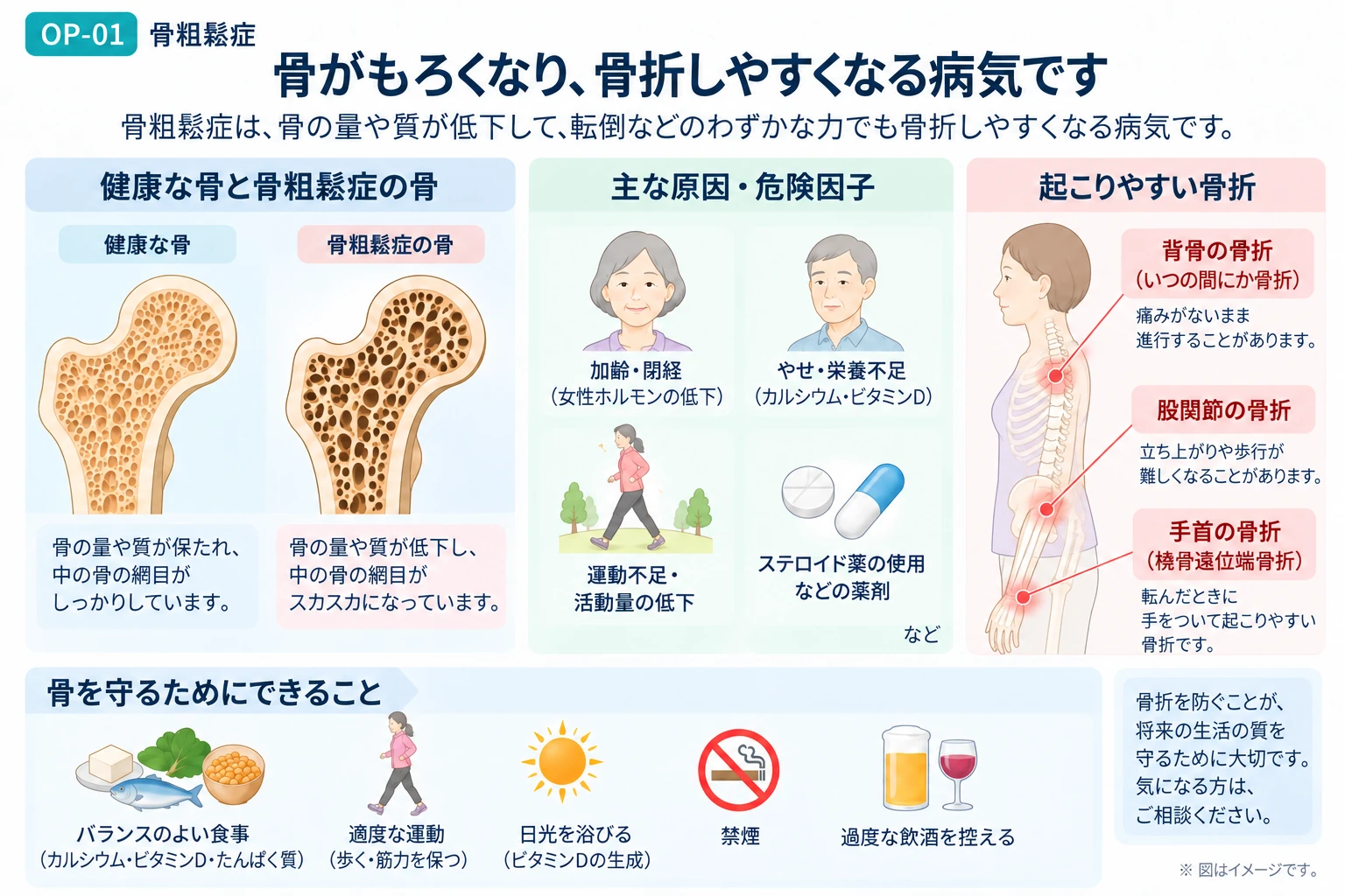 骨粗鬆症で骨が弱くなり、骨折を防ぐことが重要である全体像を説明する図