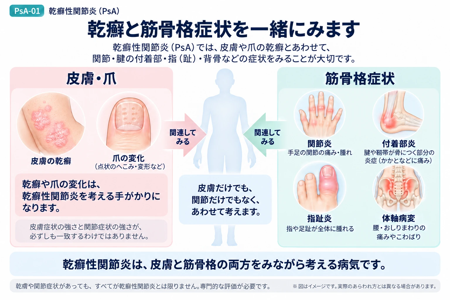 乾癬性関節炎の病気の全体像を説明する図