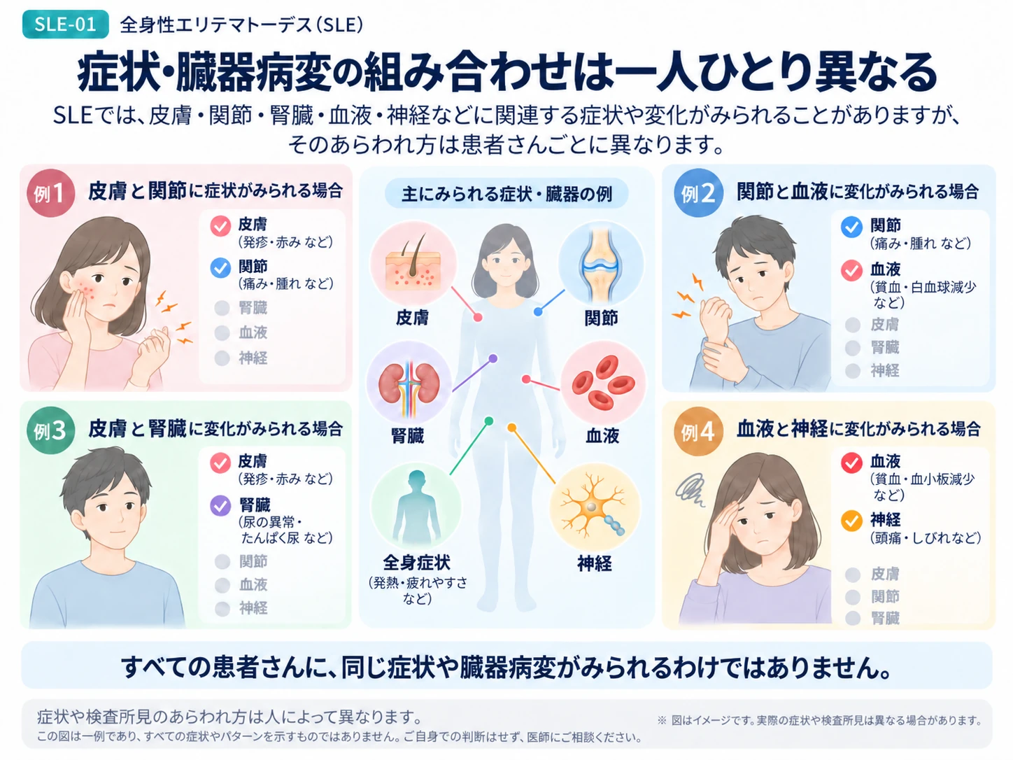 全身性エリテマトーデスでは症状や臓器病変の組み合わせが人によって異なることを説明する図