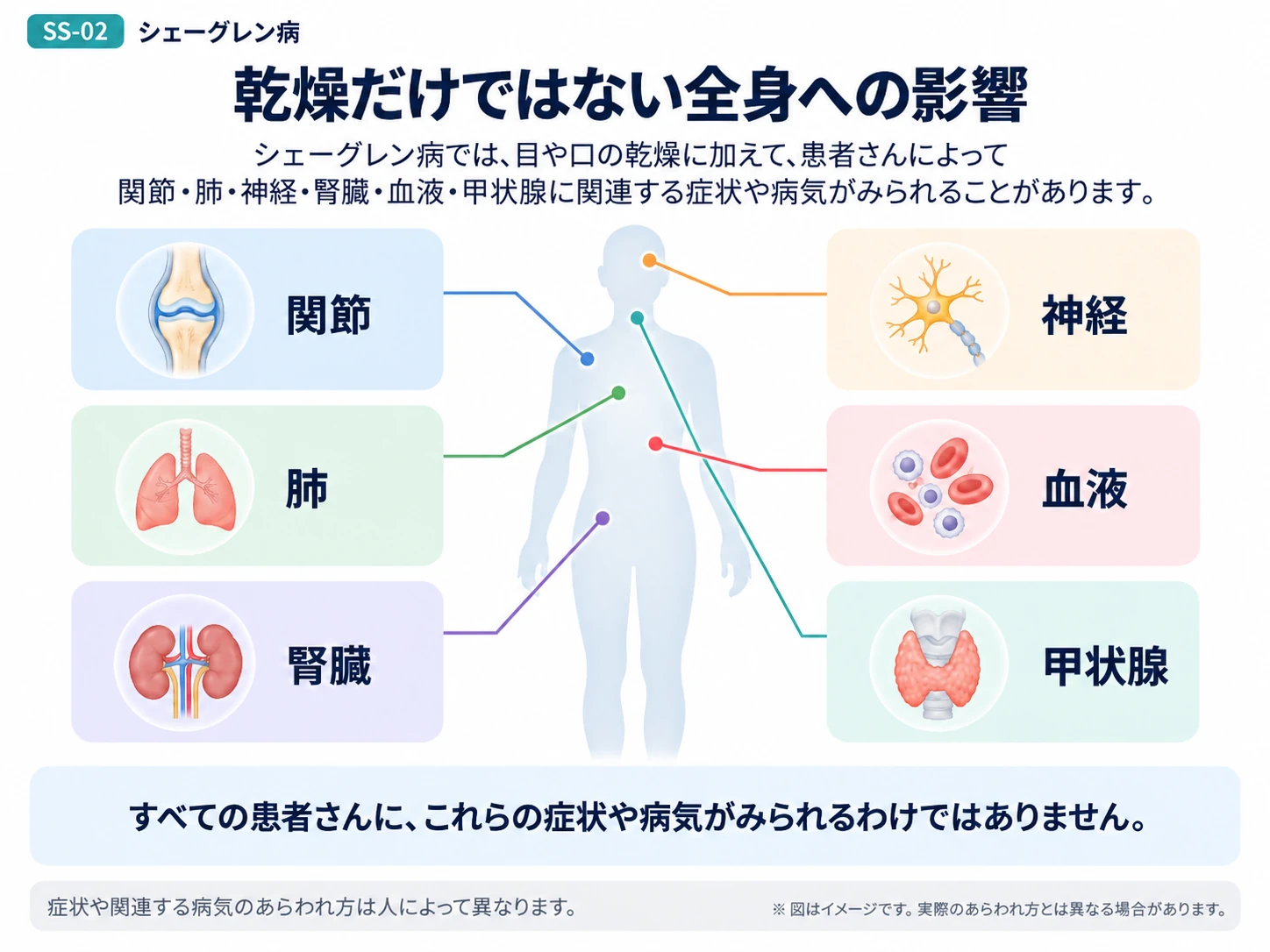 シェーグレン病の主な症状や評価の考え方を説明する図