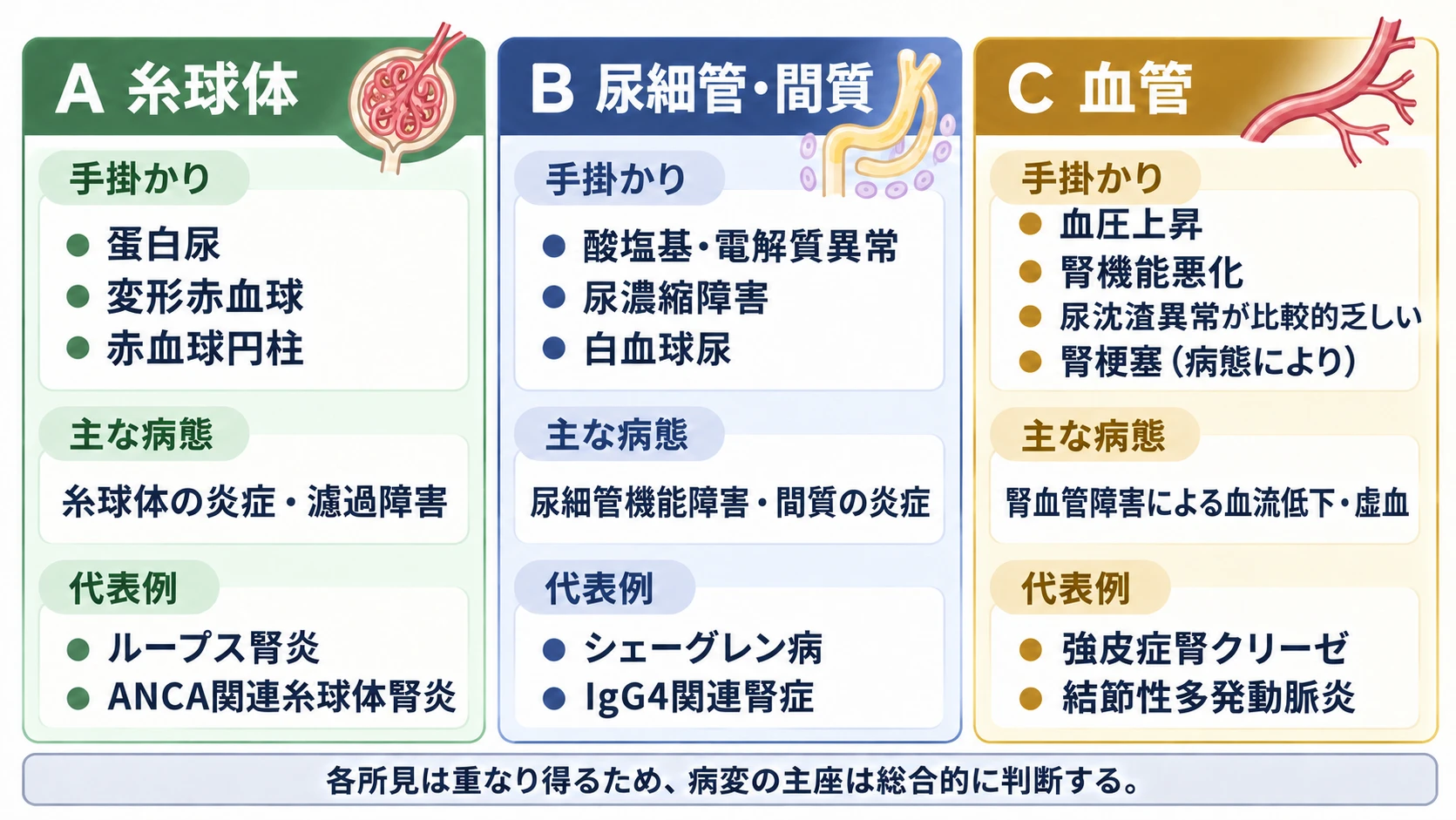 腎病変の主座を3つに分けて比べた図。A 糸球体:手掛かりは蛋白尿・変形赤血球・赤血球円柱、主な病態は糸球体の炎症・濾過障害、代表例はループス腎炎とANCA関連糸球体腎炎。B 尿細管・間質:手掛かりは酸塩基・電解質異常・尿濃縮障害・白血球尿、主な病態は尿細管機能障害・間質の炎症、代表例はシェーグレン病とIgG4関連腎症。C 血管:手掛かりは血圧上昇・腎機能悪化・尿沈渣異常が比較的乏しい・腎梗塞(病態により)、主な病態は腎血管障害による血流低下・虚血、代表例は強皮症腎クリーゼと結節性多発動脈炎。各所見は重なり得るため、病変の主座は総合的に判断する。
