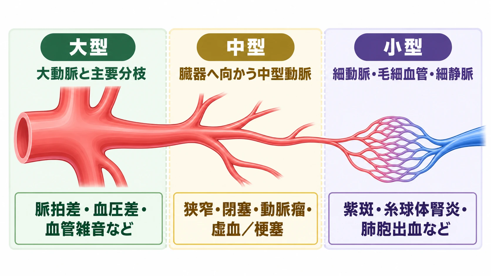 血管を大型・中型・小型の3つに分けた図。大型は大動脈と主要分枝で、脈拍差・血圧差・血管雑音など。中型は臓器へ向かう中型動脈で、狭窄・閉塞・動脈瘤・虚血／梗塞。小型は細動脈・毛細血管・細静脈で、紫斑・糸球体腎炎・肺胞出血など。